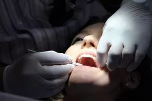 Обнаружить начальную стадию кариеса поможет инфракрасная камера Обнаружить начальную стадию кариеса поможет инфракрасная камера
